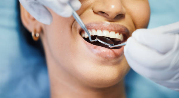 Best Broken or Chipped Tooth Repair in Isanti, MN