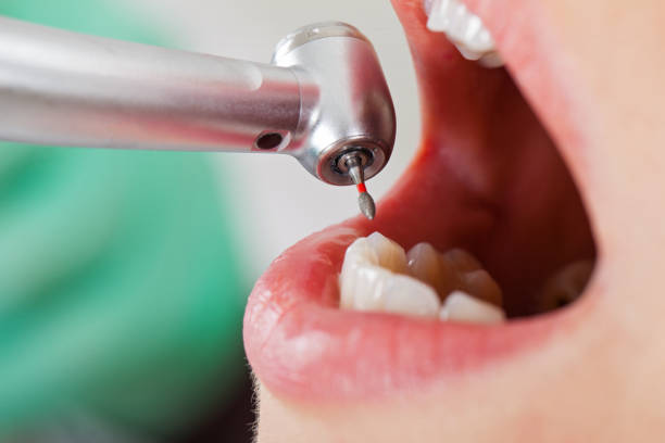 Best Walk-In Emergency Dental Services in Isanti, MN